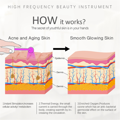 4 in 1 High-Frequency Electrode Beauty Device